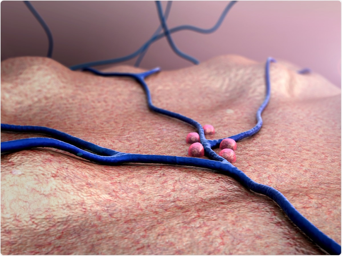 Study: ACE2 and SARS-CoV-2 Expression in the Normal and COVID-19 Pancreas. Image credit: UGREEN 3S / Shutterstock