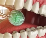 What Microorganisms Naturally Live in the Mouth?