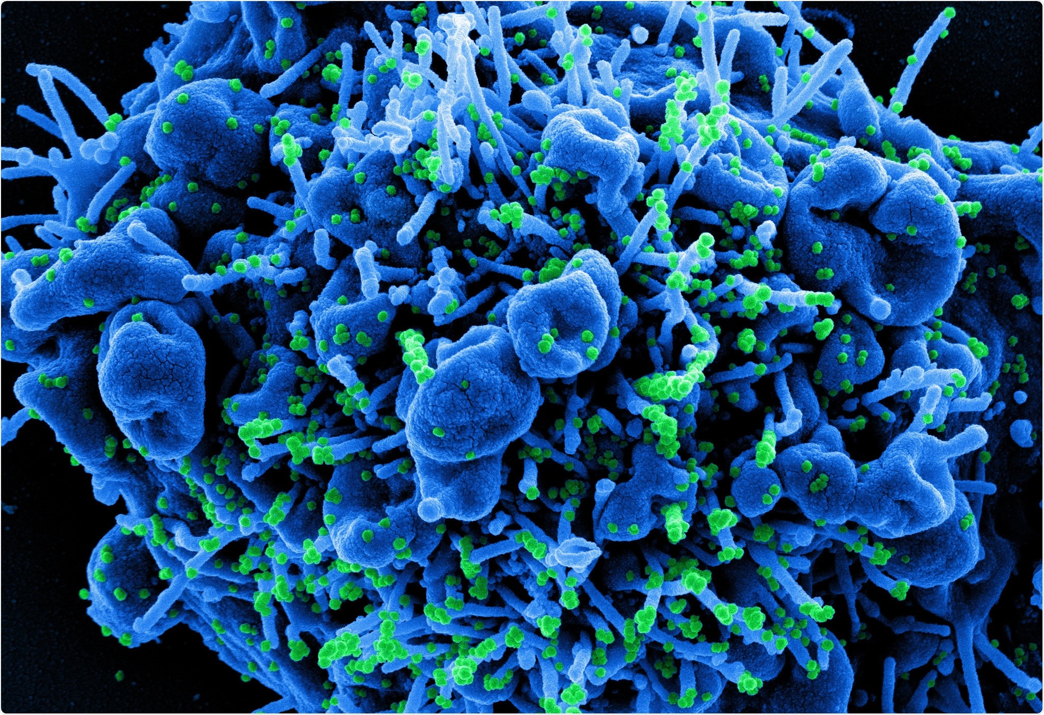Study: Immunisation, asymptomatic infection, herd immunity and the new variants of COVID 19. Image Credit: NIAID
