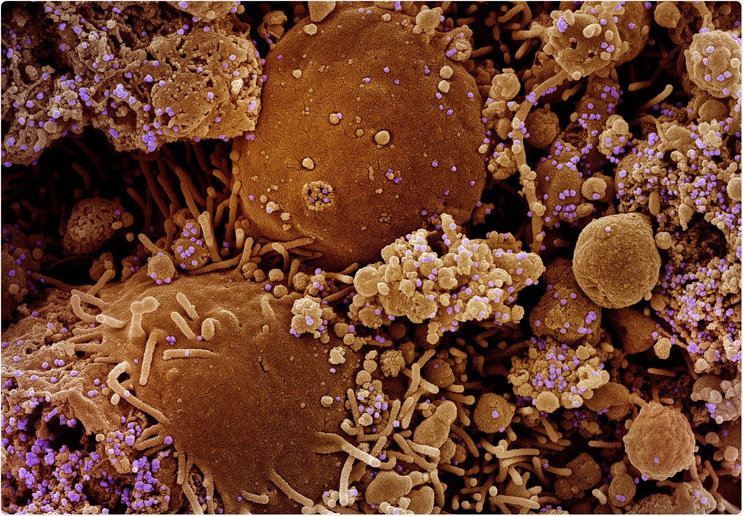 Study: Persistence of infectious SARS-CoV-2 particles for up to 37 days in patients with mild COVID-19. Image Credit: NIAID