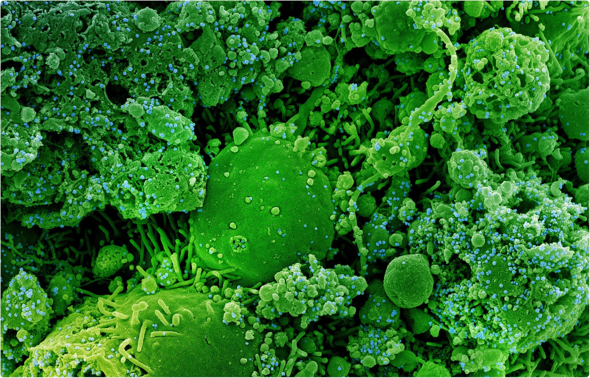 Study: Myocarditis after Covid-19 Vaccination in a Large Health Care Organization. Image Credit: NIAID