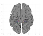 Study explores how the female brain responds to genital touch