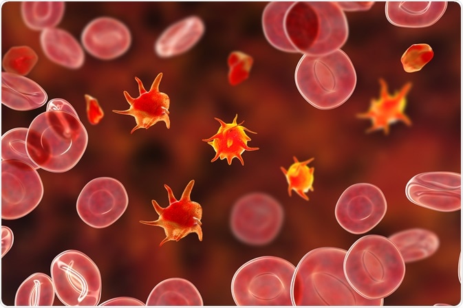 Bernard-Soulier syndrome