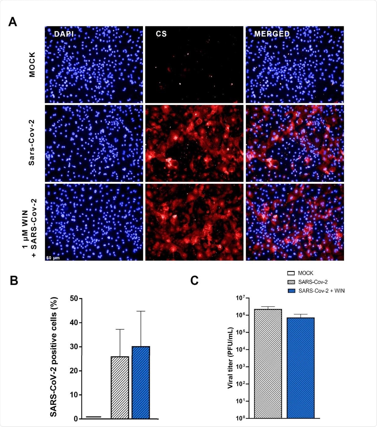 WIN does not reduce SARS-CoV-2 infection and replication in hiPSC-CMs. (A) Immunomicrographs of MOCK and SARS-CoV-2-infected hiPSC-CM pre-treated or not with 1 μM WIN for 24 hours. hiPSC-CM were immunostained for SARS-CoV-2 convalescent serum (CS) (red) and counterstained with DAPI (blue) at 48h post-infection. Scale bar: 50 μm. (B) Percentage of CS positive cells. CS immunoreactivity was comparable between treated (30±15%) and untreated (26±12%) hiPSC-CM. (C) Viral titer quantification by plaque forming units assay using the supernatants of the SARS-CoV-2 infected hiPSC-CMs. Viral titer was comparable between treated (6.99 × 105±4.39 × 105 PFU/mL) and untreated (2.18 × 106±9.96 × 105 PFU/mL) hiPSC-CM. Error bars represent standard errors of the means (SEMs) from three independent experiments.