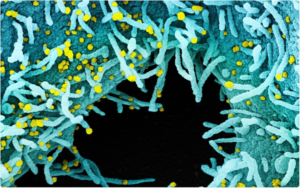 Study: Laser-facilitated epicutaneous immunization with SARS-CoV-2 spike protein induces ACE2 blocking antibodies in mice. Image Credit: NIAID / Flickr