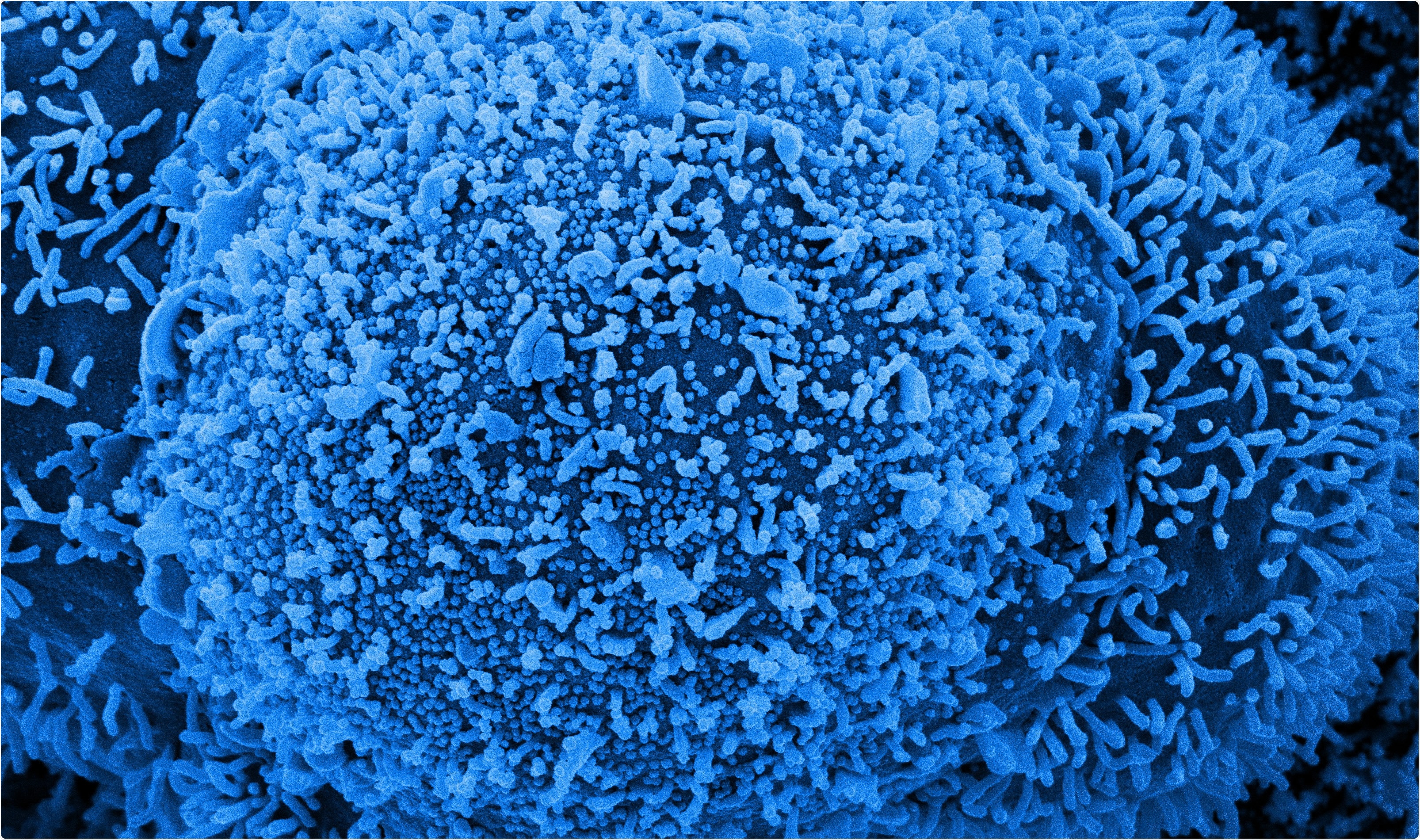 Study: Transmission of COVID-19 in 282 clusters in Catalonia, Spain: a cohort study. Image Credit: NIAID