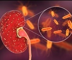 Pyelonephritis Symptoms