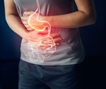 Causes of Bleeding in the Upper and Lower Gastrointestinal Tract