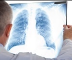 What is Pulmonary Function Testing?