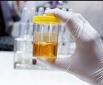 What Does 24-Hour Urine Collection Test Involve?