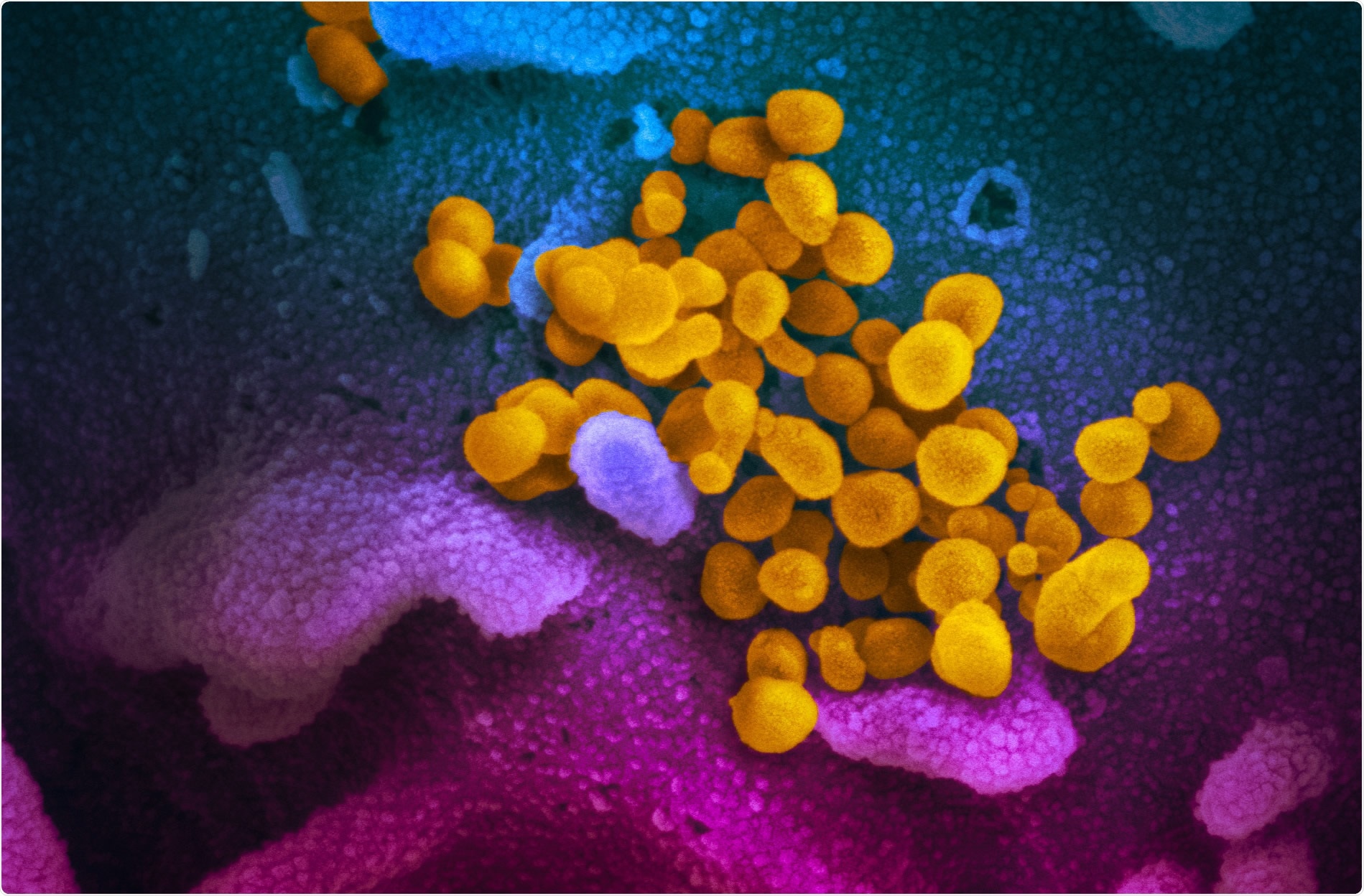 Study: Persistence of SARS-CoV-2 virus and viral RNA on hydrophobic and hydrophilic surfaces and investigating contamination concentration. Image Credit: NIAID