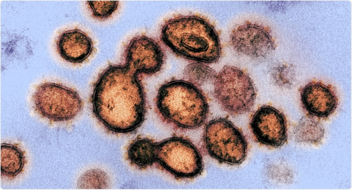 Study: Transposable elements as sensors of SARS-CoV-2 infection. Image Credit: NIAID / Flickr