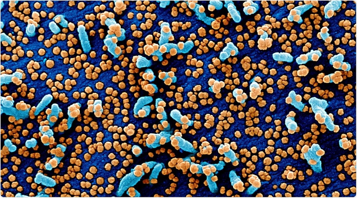Study: A pharmacophore model for SARS-CoV-2 3CLpro small molecule inhibitors and in vitro experimental validation of computationally screened inhibitors. Image Credit: NIAID / Flickr