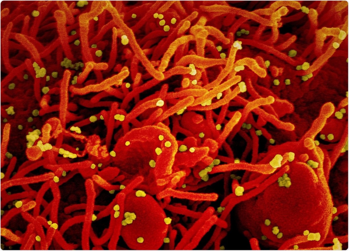 Study: Protease-activatable biosensors of SARS-CoV-2 infection for cell-based drug, neutralisation and virological assays. Image Credit: NIAID / Flickr