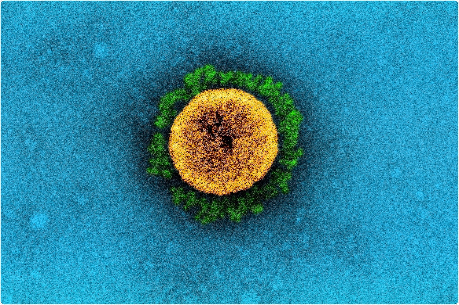 Transmission electron micrograph of a SARS-CoV-2 virus particle (UK B.1.1.7 variant), isolated from a patient sample and cultivated in cell culture. The prominent projections (green) seen on the outside of the virus particle (yellow) are spike proteins. This fringe of proteins enables the virus to attach to and infect host cells and then replicate. Image captured at the NIAID Integrated Research Facility (IRF) in Fort Detrick, Maryland. Credit: NIAID