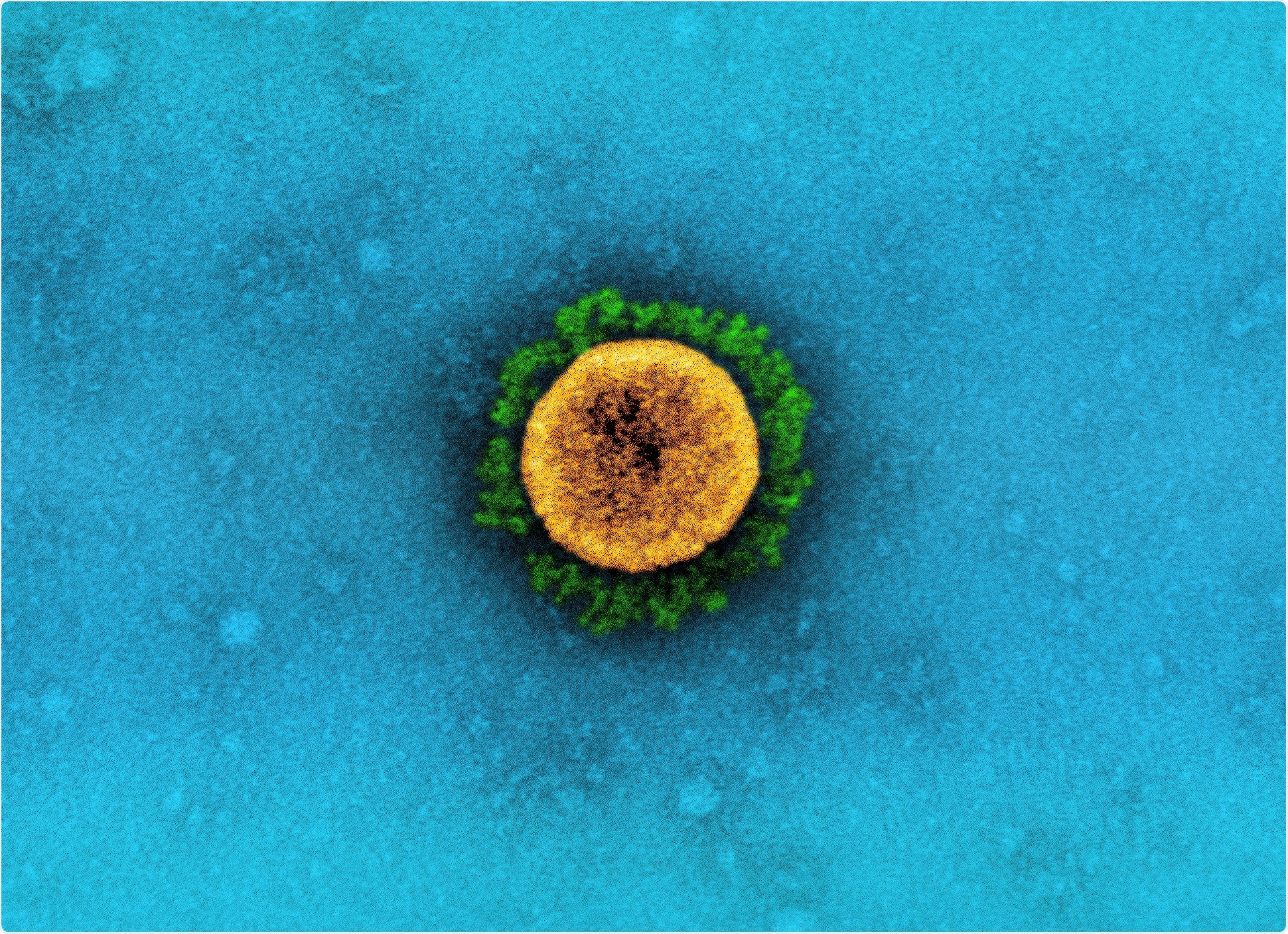 Study: Case fatality risk of the SARS-CoV-2 variant of concern B.1.1.7 in England. Image Credit: NIAID