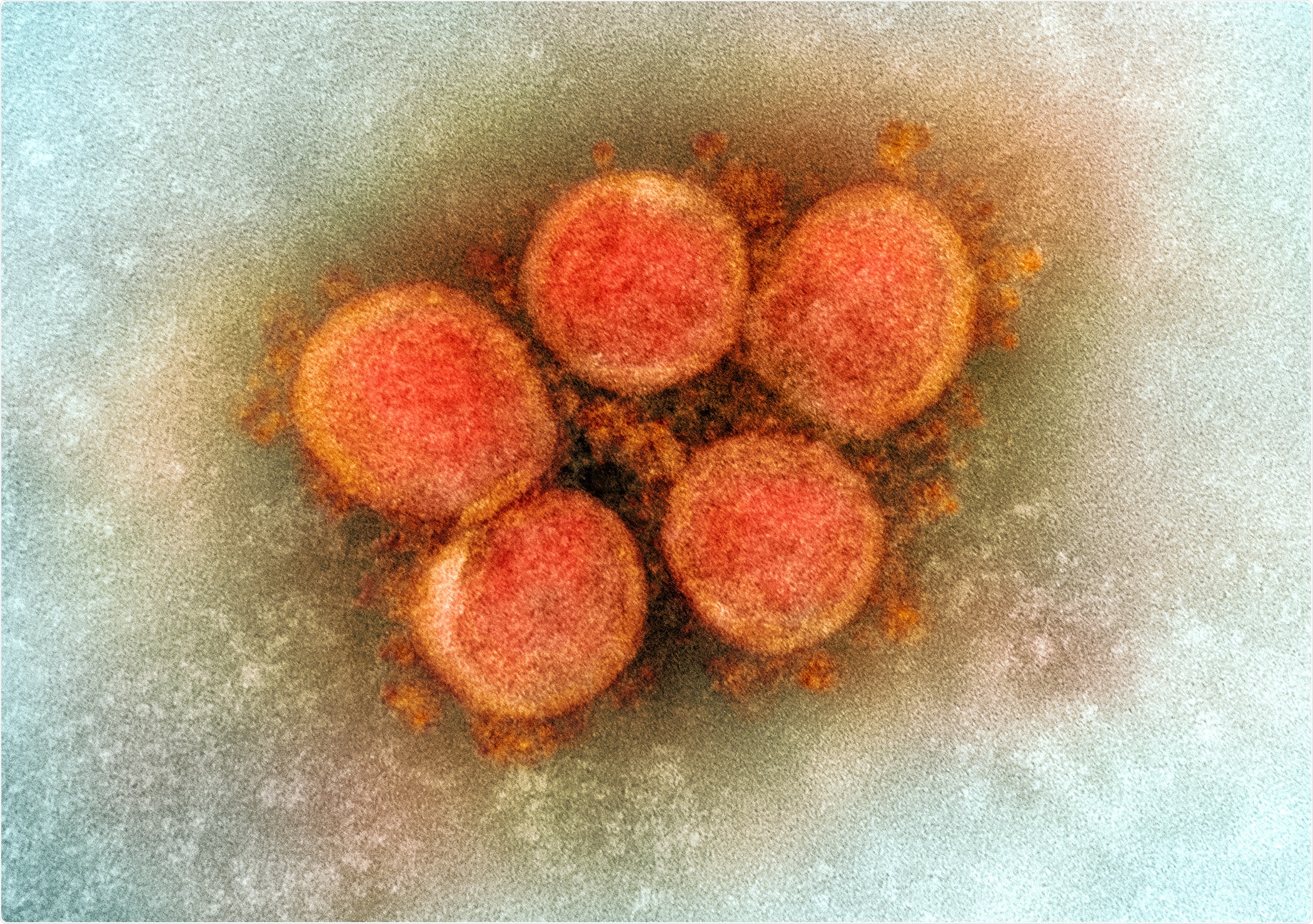 Study: SARS-CoV-2 Viremia is Associated with Distinct Proteomic Pathways and Predicts COVID-19 Outcomes. Image Credit: NIAID