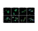 Hypoxic Signaling: Recombinant Rabbit Monoclonal Antibodies for HIF1-alpha and HIF2-alpha