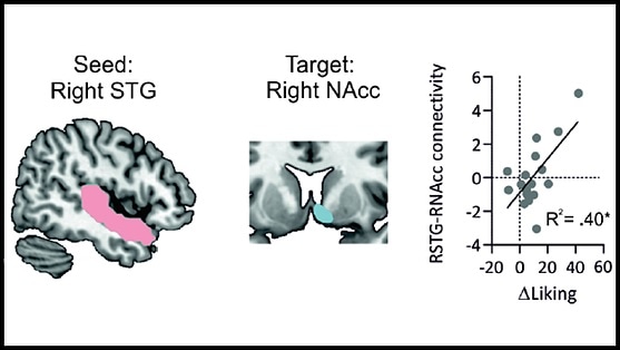 Communication between the brain’s auditory and reward circuits underpins music-induced pleasure