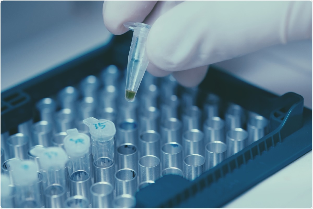 Image Credit: Hand Robot / Shutterstock