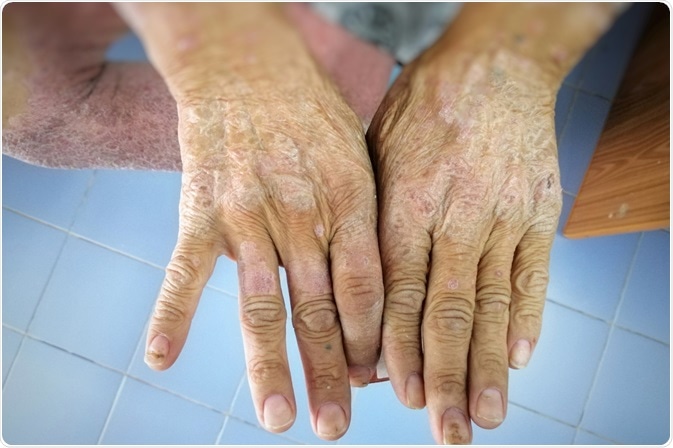 Image Credit: Numstocker / Shutterstock