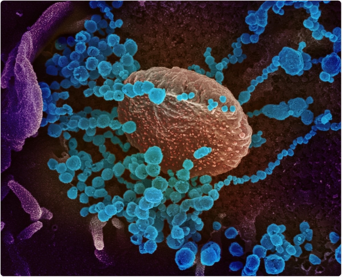 Study: Discovery and in-vitro evaluation of potent SARS-CoV-2 entry inhibitors. Image Credit: NIAID / Flickr