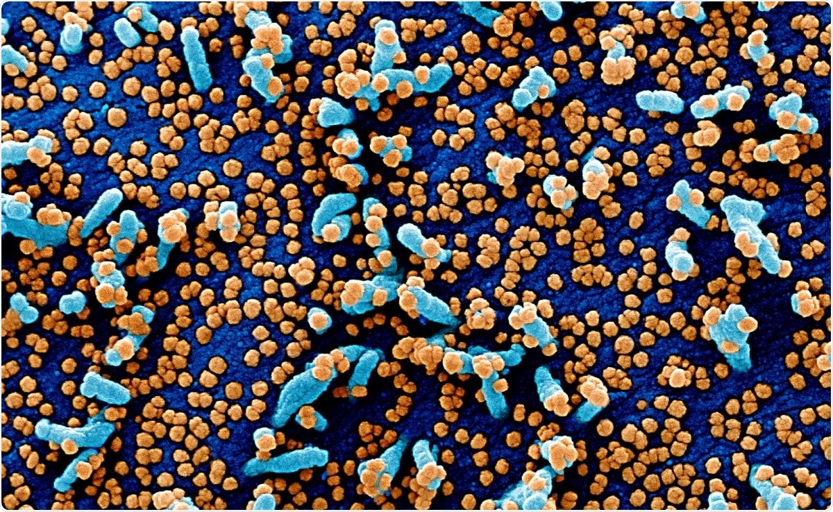 Study: Elevated anti-SARS-CoV-2 antibodies and IL-6, IL-8, MIP-1β, early predictors of severe COVID-19. Image Credit: NIAID / Flickr