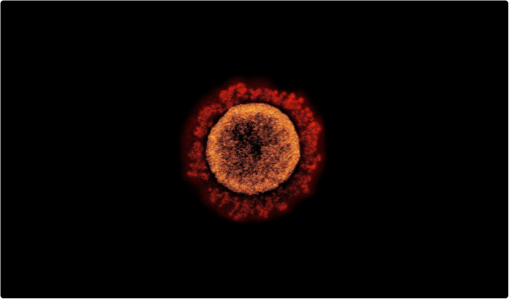 Study: INO-4800 DNA Vaccine Induces Neutralizing Antibodies and T cell Activity Against Global SARS-CoV-2 Variants. Image Credit: NIAID