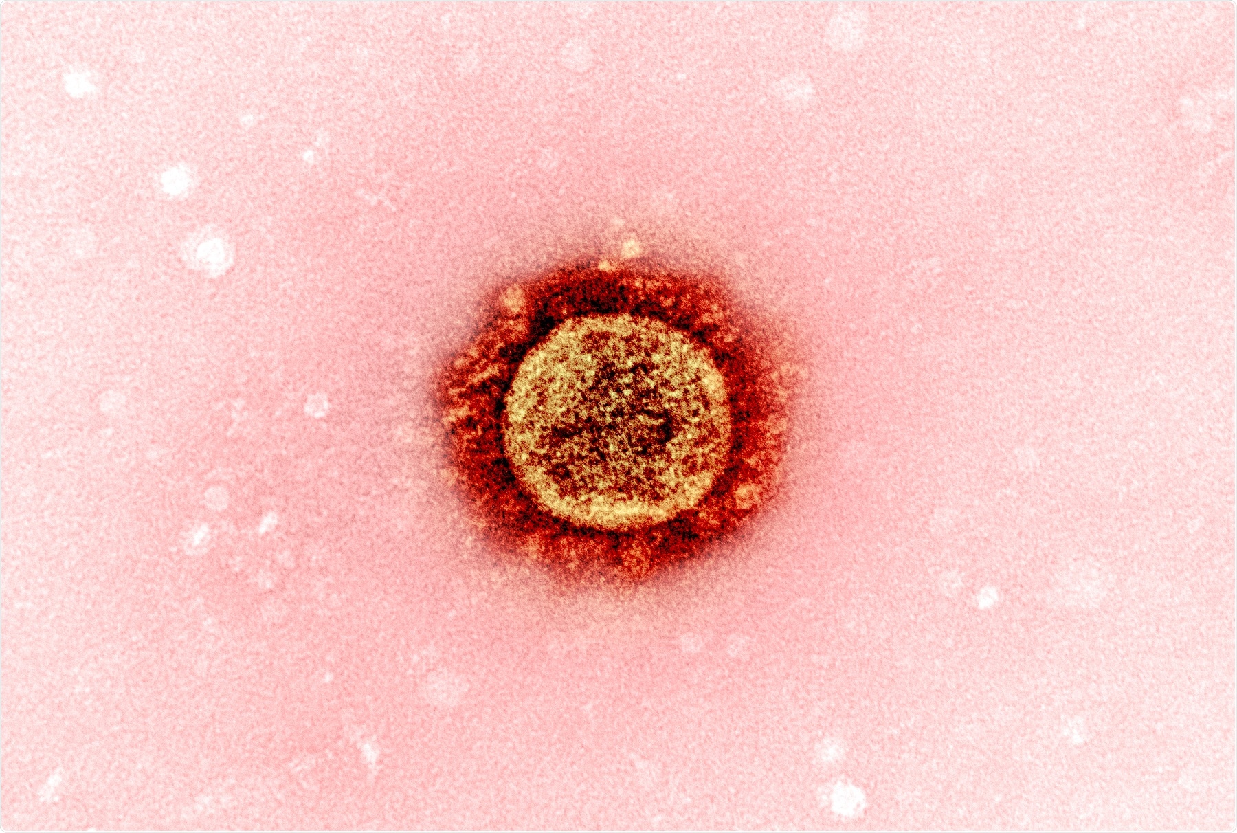 Study: Hydrogel-based slow release of a receptor-binding domain subunit vaccine elicits neutralizing antibody responses against SARS-CoV-2. Image Credit: NIAID