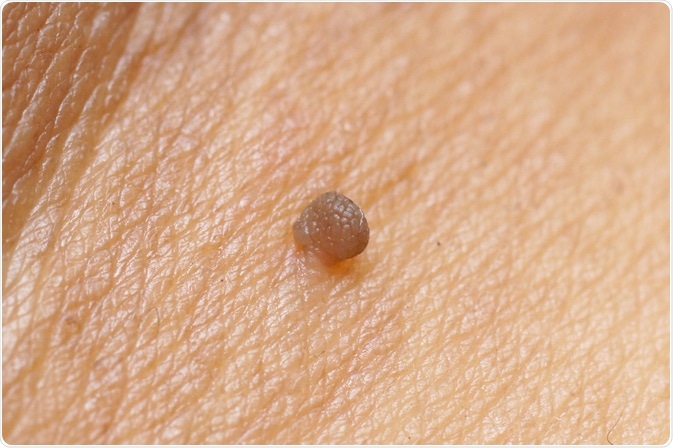 Image Credit: wk1003mike / Shutterstock