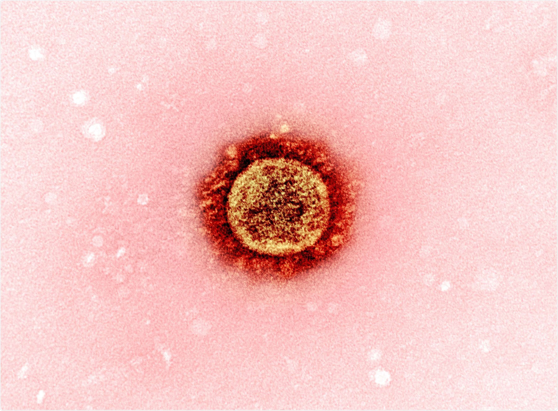 Study: Long-lasting neutralizing antibody responses in SARS-CoV-2 seropositive individuals are robustly boosted by immunization with the CoronaVac and BNT162b2 vaccines. Image Credit: NIAID