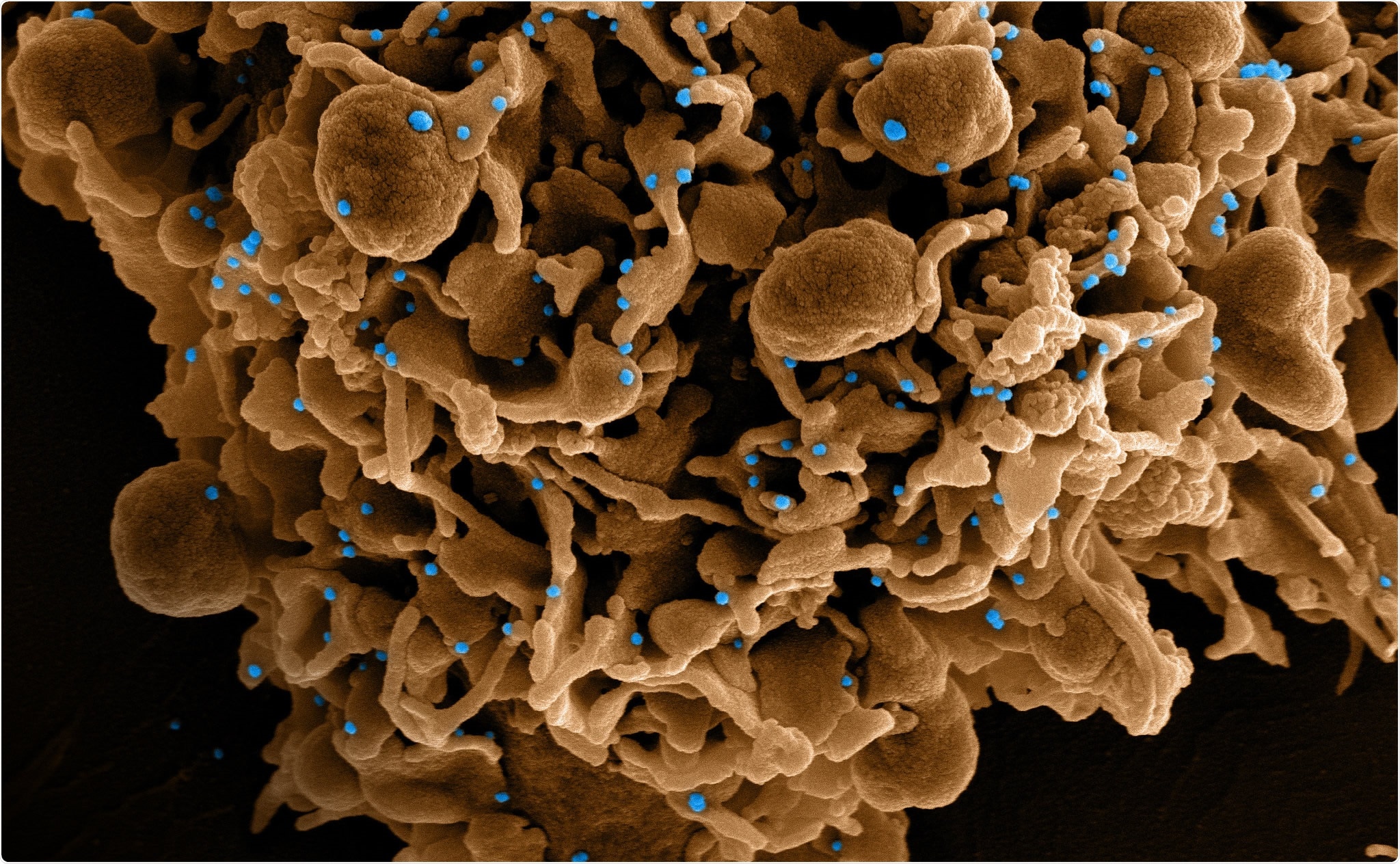Study: Quantifying the potential for dominant spread of SARS-CoV-2 variant B.1.351 in the United States. Image Credit: NIAID