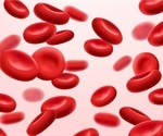 Causes of Anemia