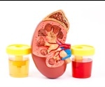 Types of Hematuria