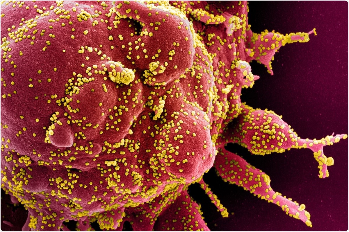 Study: SARS-CoV-2 activates ER stress and Unfolded protein response. Image Credit: NIAID / Flickr