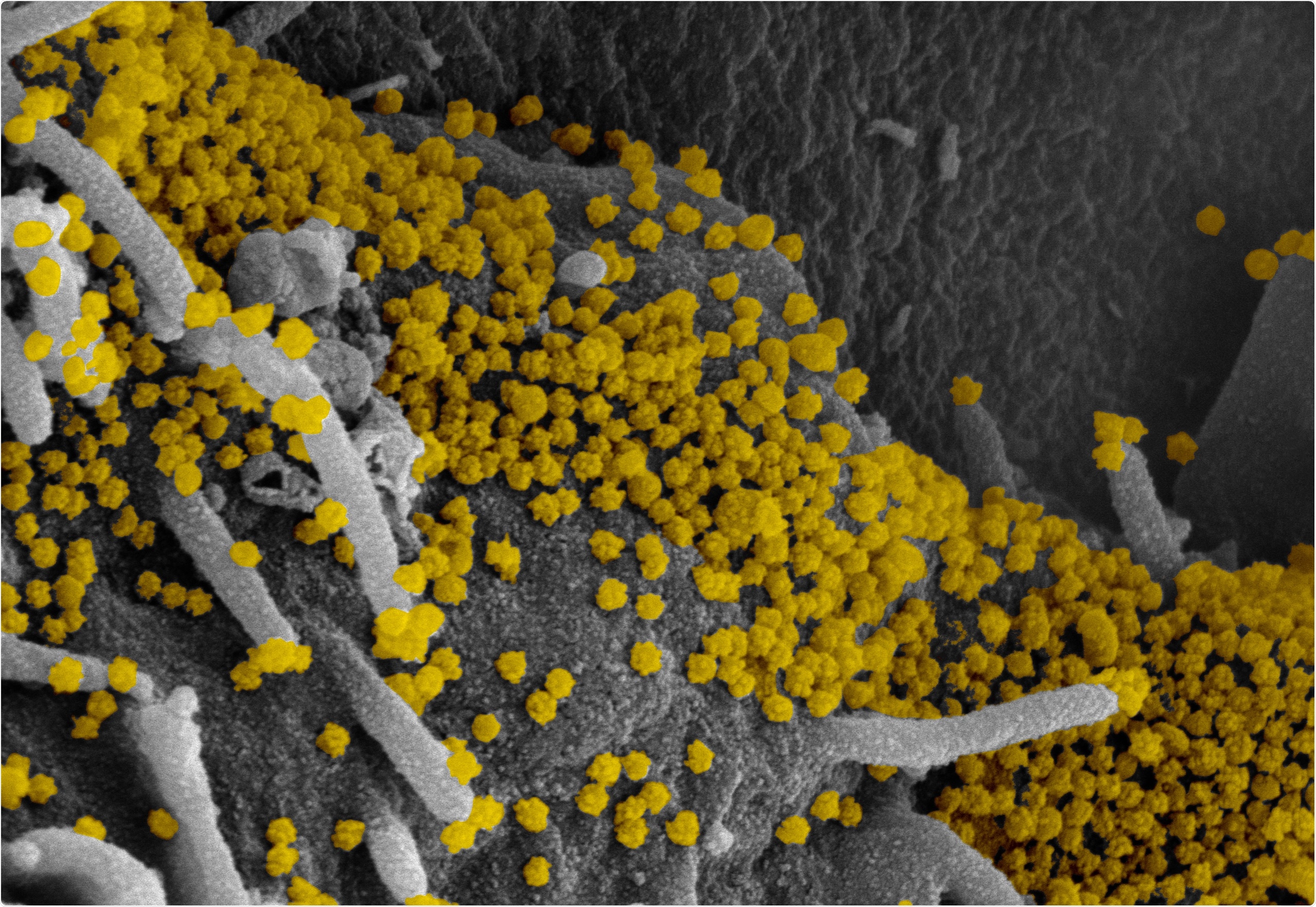 Study: Correlates of protection against symptomatic and asymptomatic SARS-CoV-2 infection. Image Credit: NIAID