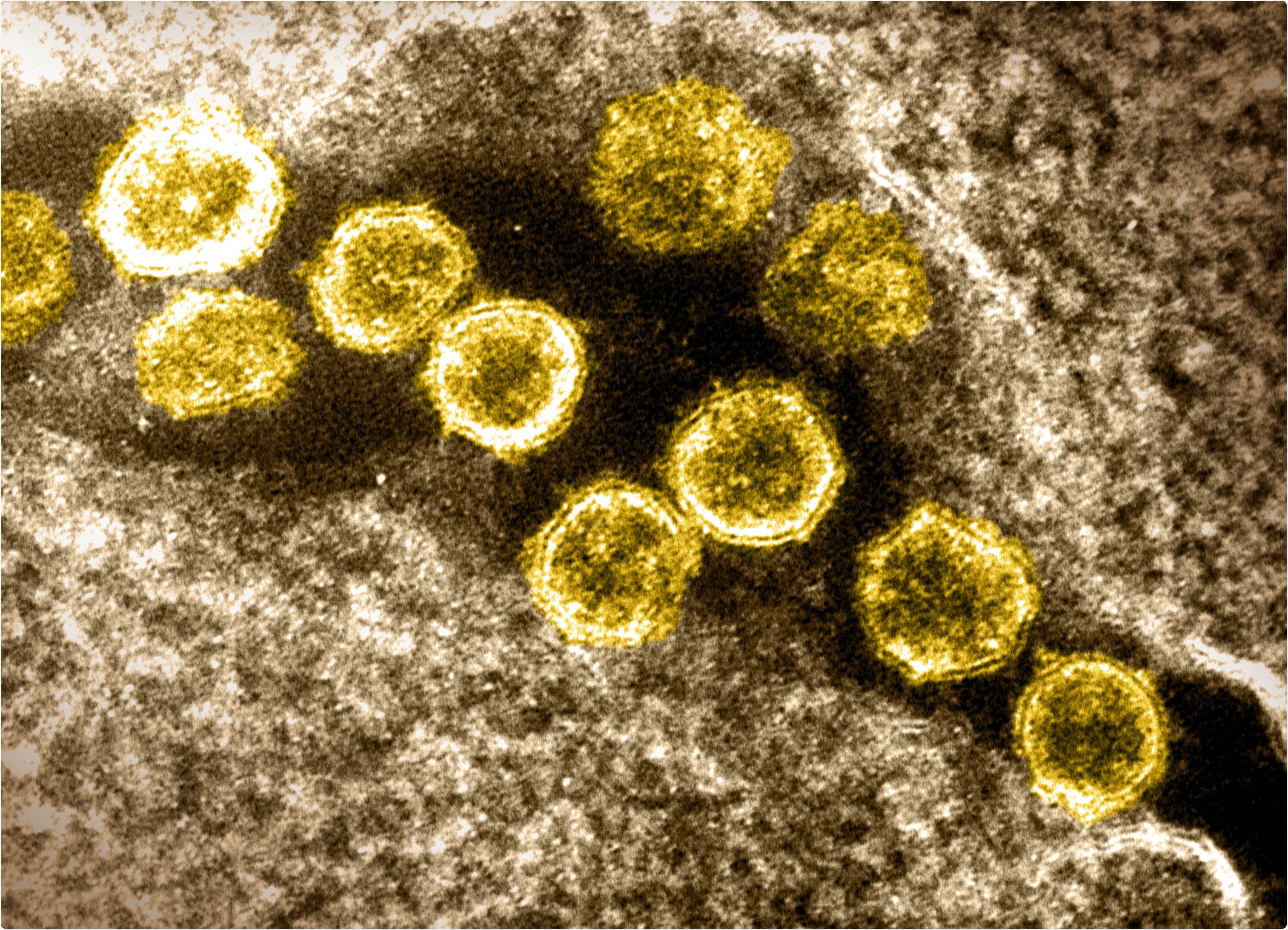 Study: Persistence of SARS CoV-2 S1 Protein in CD16+ Monocytes in Post-Acute Sequelae of COVID-19 (PASC) Up to 15 Months Post-Infection. Image Credit: NIAID