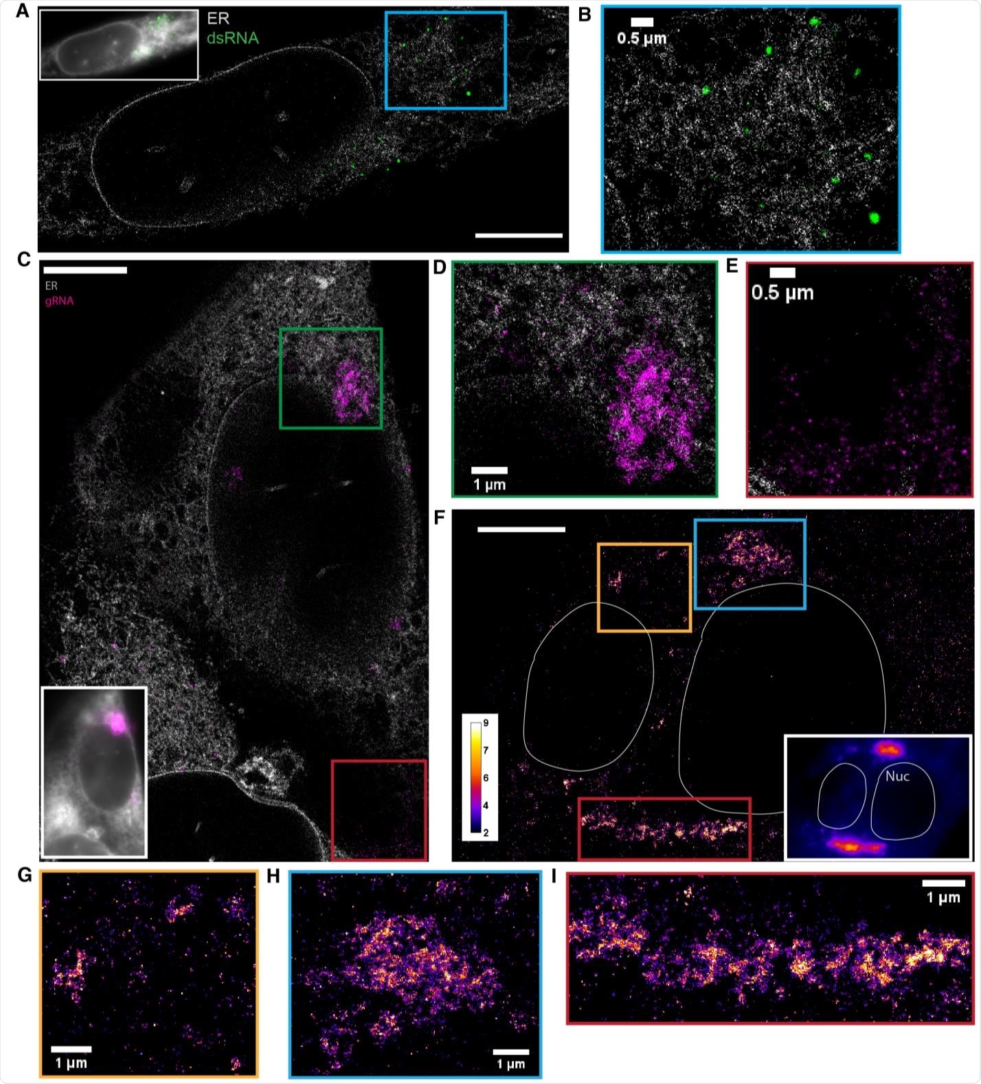 dsRNA forms puncta separated from ER while gRNA clusters frequently associate with the ER (A) Two-color SR reconstruction of a cell at 24 h p.i. where the ER (gray) and dsRNAs (green) are labeled. Scale bar: 5 μm. (B) Zoom-in of the boxed region. dsRNA forms compact puncta that appear in regions outside of the ER network. (C) Two-color SR reconstruction of a cell where the ER (gray) and gRNA (magenta) are labeled. Scale bar: 5 μm. (D) Zoom-ins of the green boxed region. gRNA forms clusters of various sizes, some of which exhibit poorly defined boundaries. The extended network of clusters is often closely associated with the ER membrane. (E) A population of the genomic RNA forms small puncta of similar sizes which are not associated with the ER (cf. Figure 3). (F) One-color SR reconstruction of gRNA at 12 h p.i. Inset: DL image of the same field of view. Scale bar: 5 µm. Color bar indicates the number of single-molecule detections within each pixel. (GI) Zoom-ins of the colored boxed regions. Large clusters of the viral genome appear perinuclear and extend up to a few microns.