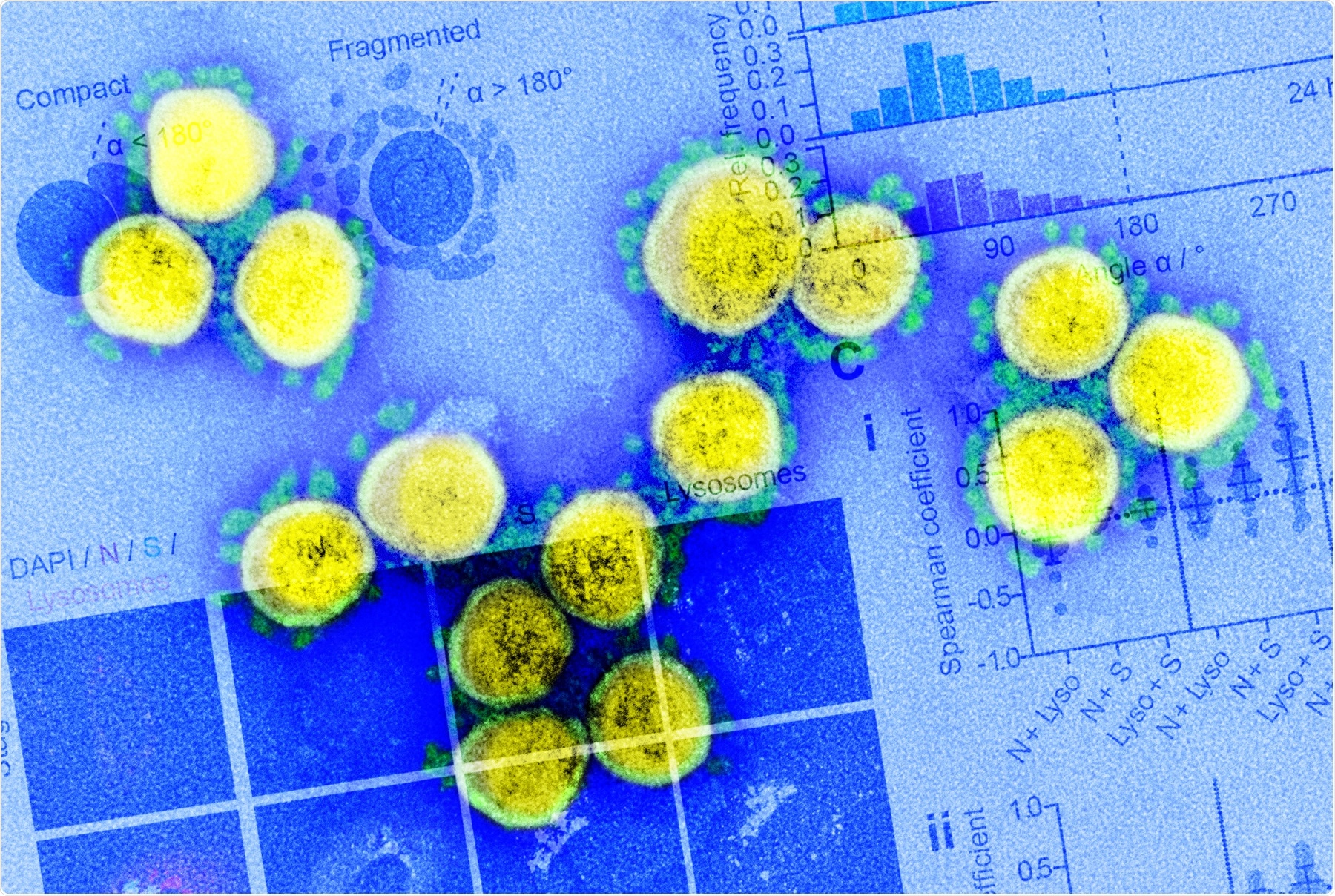 Study: The SARS-CoV-2 nucleocapsid protein associates with the replication organelles before viral assembly at the Golgi/ERGIC and lysosome-mediated egress. Image Credit: NIAID