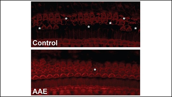 New technique shows promise as non-invasive intervention for congenital hearing loss