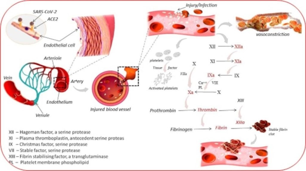 New insights can pave the way for targeted therapies to fight blood clots in COVID-19 patients