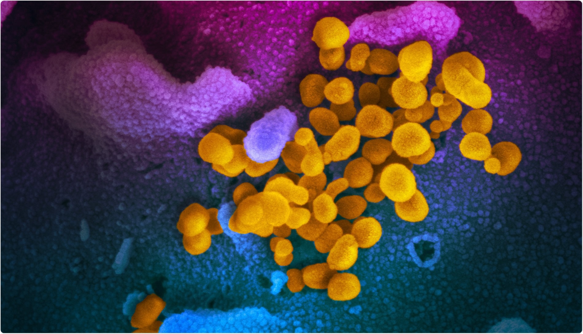 Study: Single-dose respiratory mucosal delivery of next-generation viral-vectored COVID-19 vaccine provides robust protection against both ancestral and variant strains of SARS-CoV-2. Image Credit: NIAID