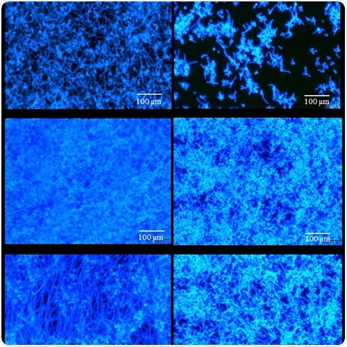 New nanobiotechnology shows remarkable ability to battle dangerous fungal infections