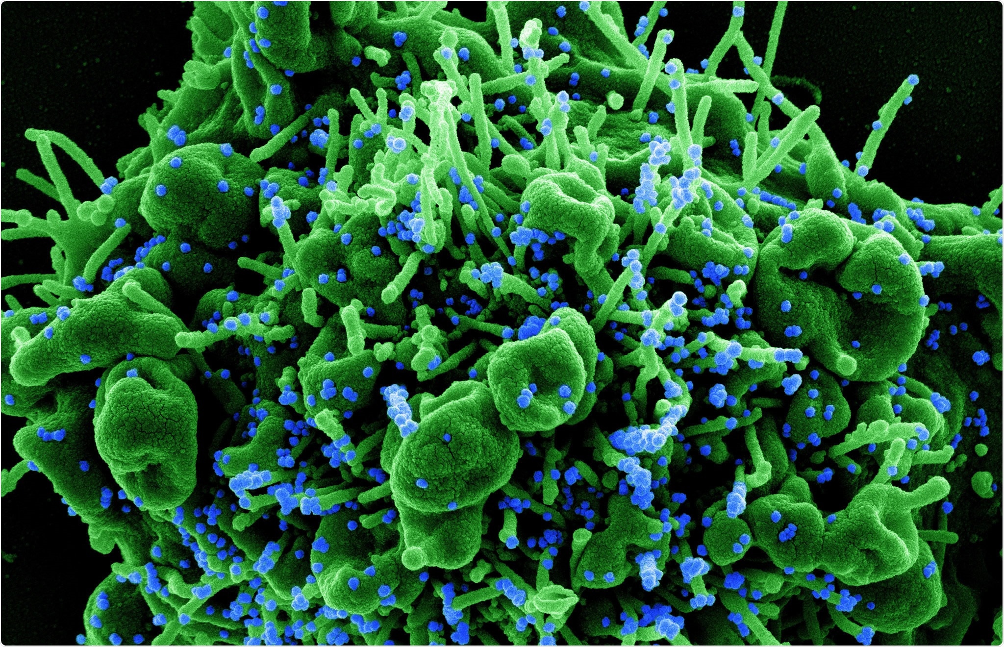 Study: Short Term Reduction in the Odds of Testing Positive for SARS-CoV-2; a Comparison Between Two Doses and Three doses of the BNT162b2 Vaccine. Image Credit: NIAID