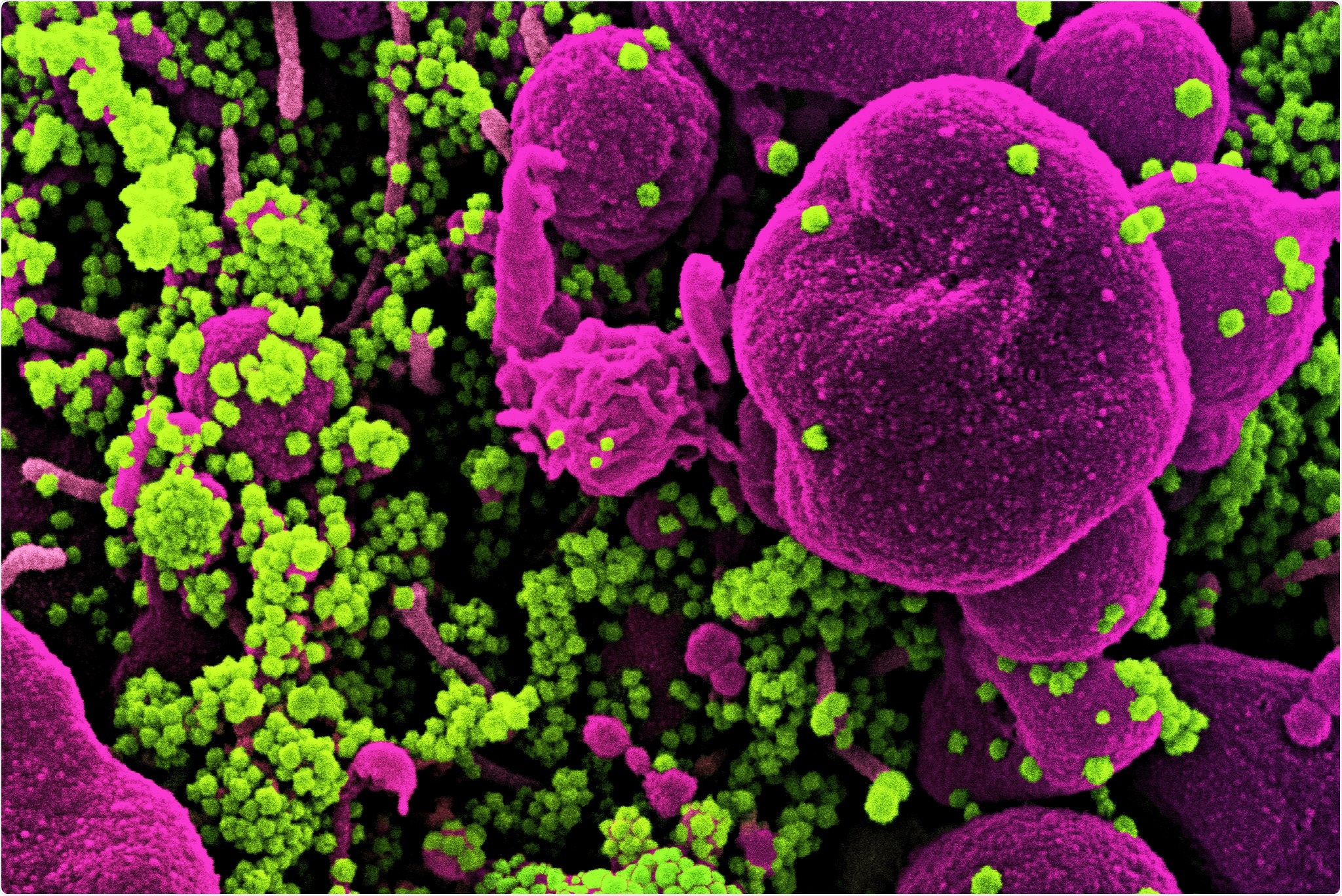 Study: Strong humoral immune responses against SARS-CoV-2 Spike after BNT162b2 mRNA vaccination with a sixteen-week interval between doses. Image Credit: NIAID