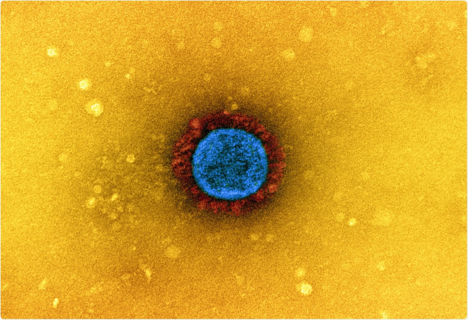 Study: RBD-homodimer, a COVID-19 subunit vaccine candidate, elicits immunogenicity and protection in rodents and nonhuman primates. Image Credit: NIAID