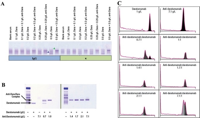 Daratumumab can be identified on IFE/SPE and can be shifted with anti-daratumumab.