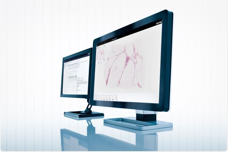 Sectra signs digital pathology contract with Erasmus MC