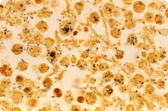 Legionella pneumophila bacteria