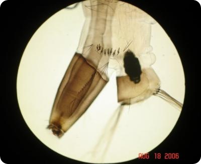 This image shows the Posterior end of an Aedes aegypti mosquito larva, the agent responsible for transmitting the Dengue virus to humans, showing characteristic siphon and spines. Credit: Adriana Troyo and Olger Calderon